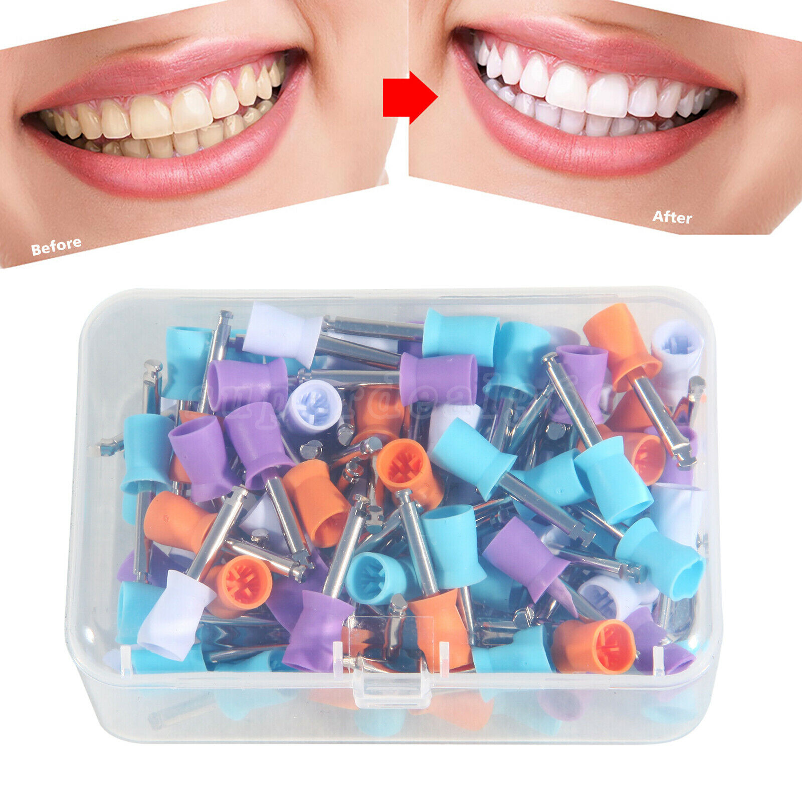 100 Dental Latch Type Paste Prophy Polishing Cups Soft Silicone Colorful Tips
