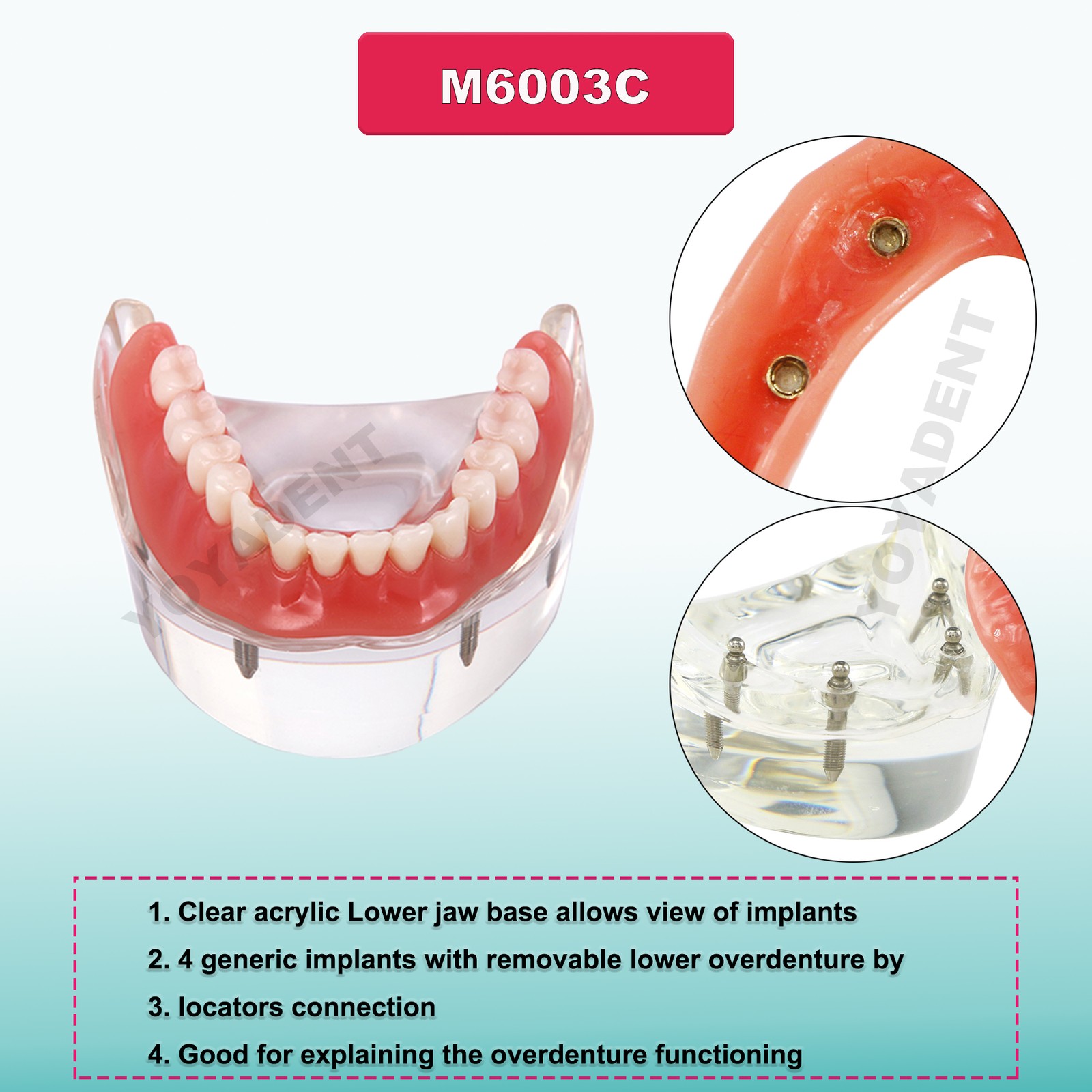 US Dental Teeth Model Implant Periodontal Disease Suture Drilling Training Demo