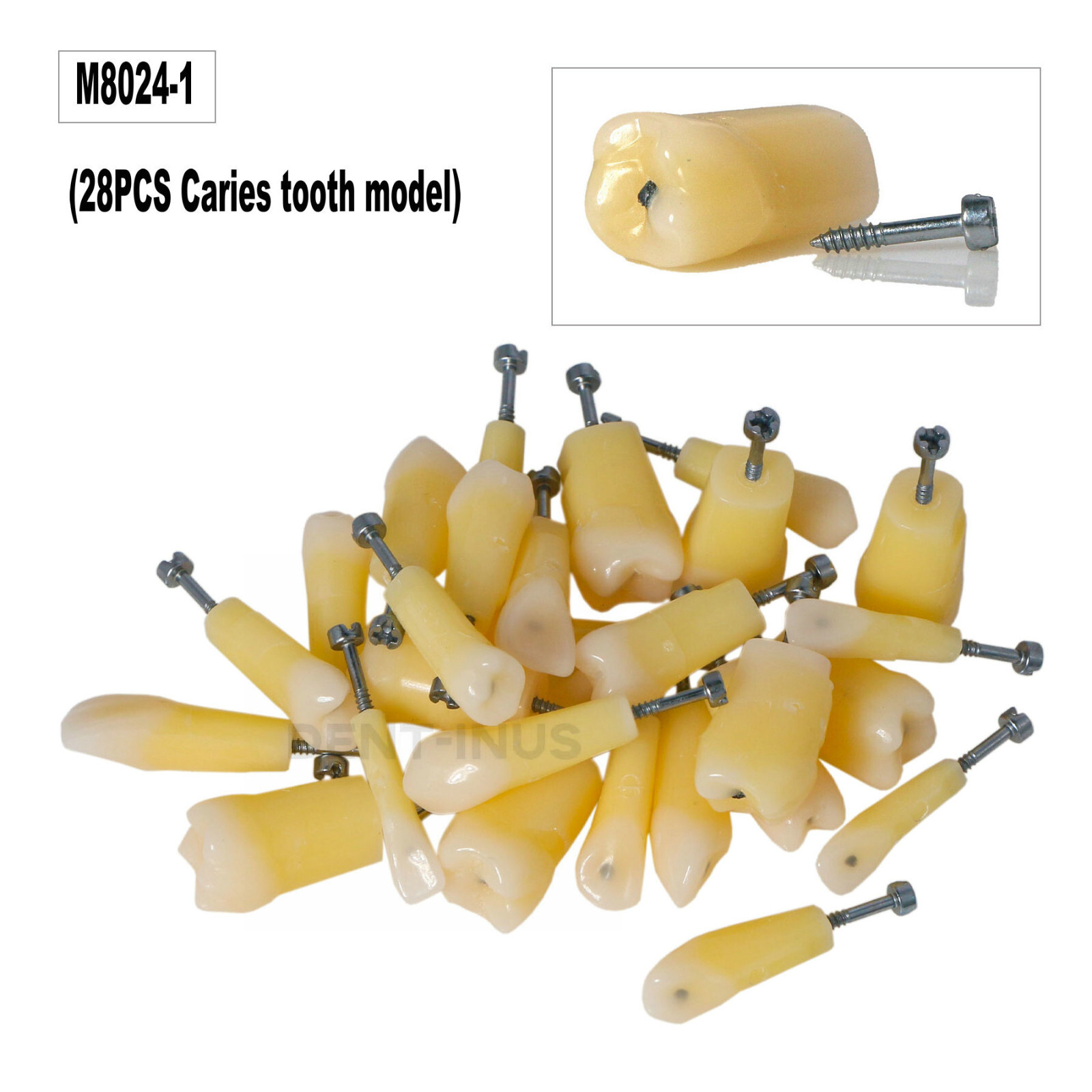 Dental Typodont Teeth Model with Caries Spots 28 Pieces Fits Kilgore Nissin 200