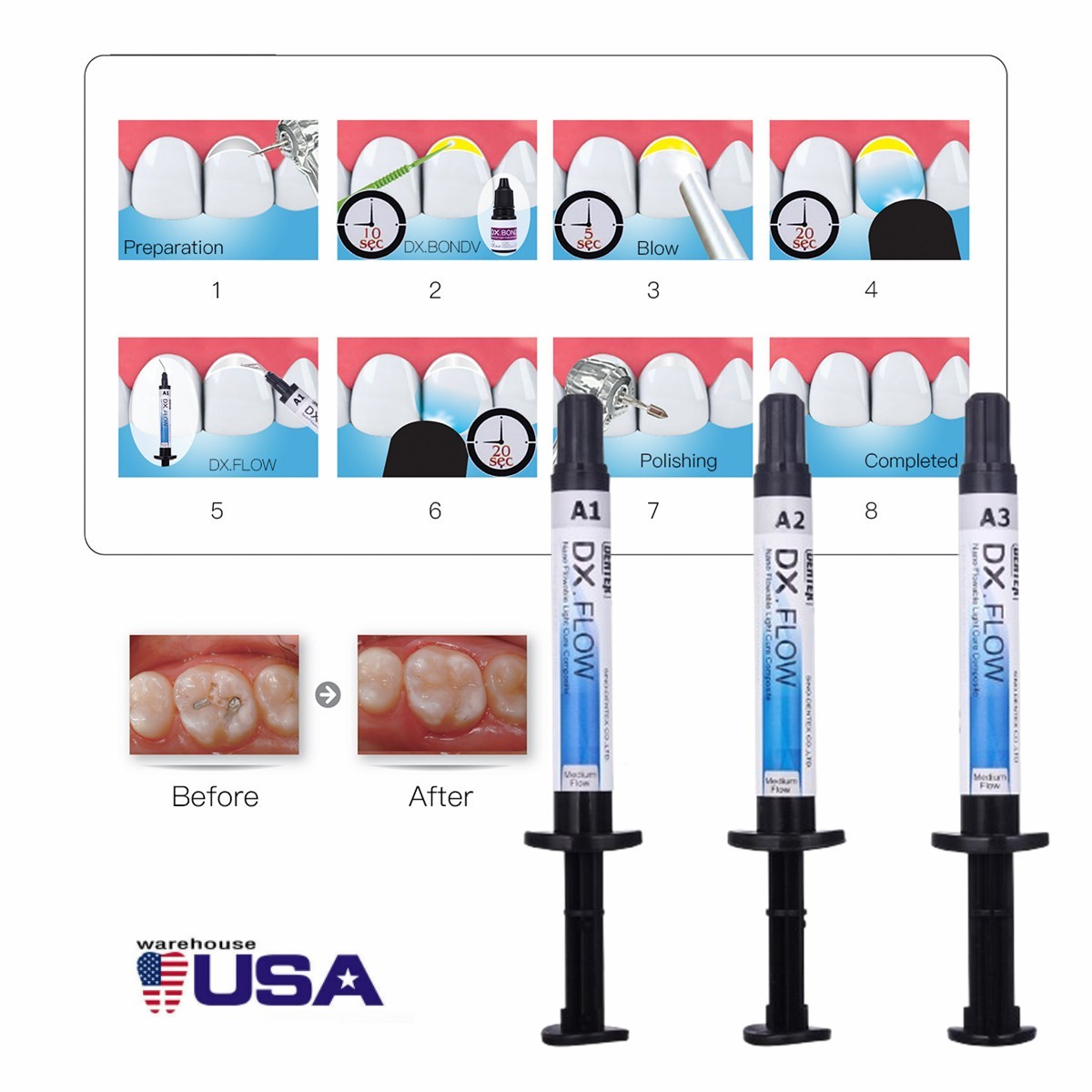 DENTEX Flowable Light Cure Composite Resin Medium Flow/Adhesive Light Cure
