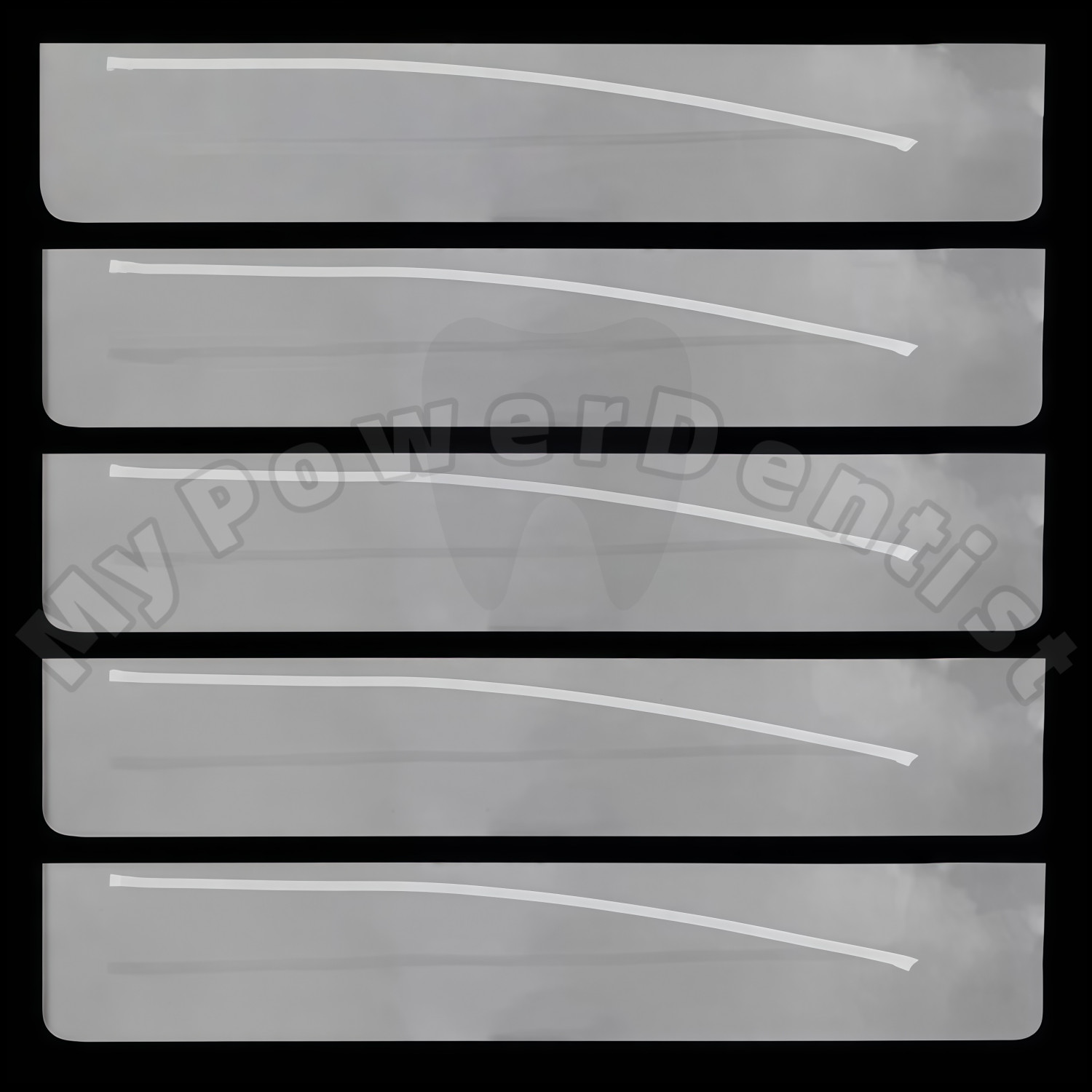 Dental Composite Flexible Fiber Strip Ribbond Ribbon Glass Fiber Bonding Strip