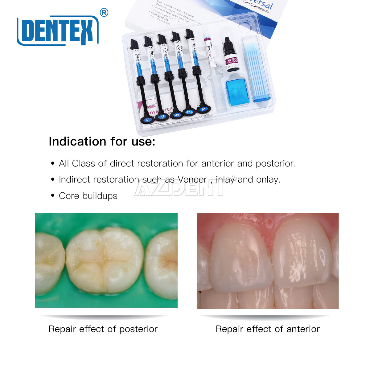 DENTEX Dental Universal Total Etching Adhesive Light Cure Composite Resin Kit