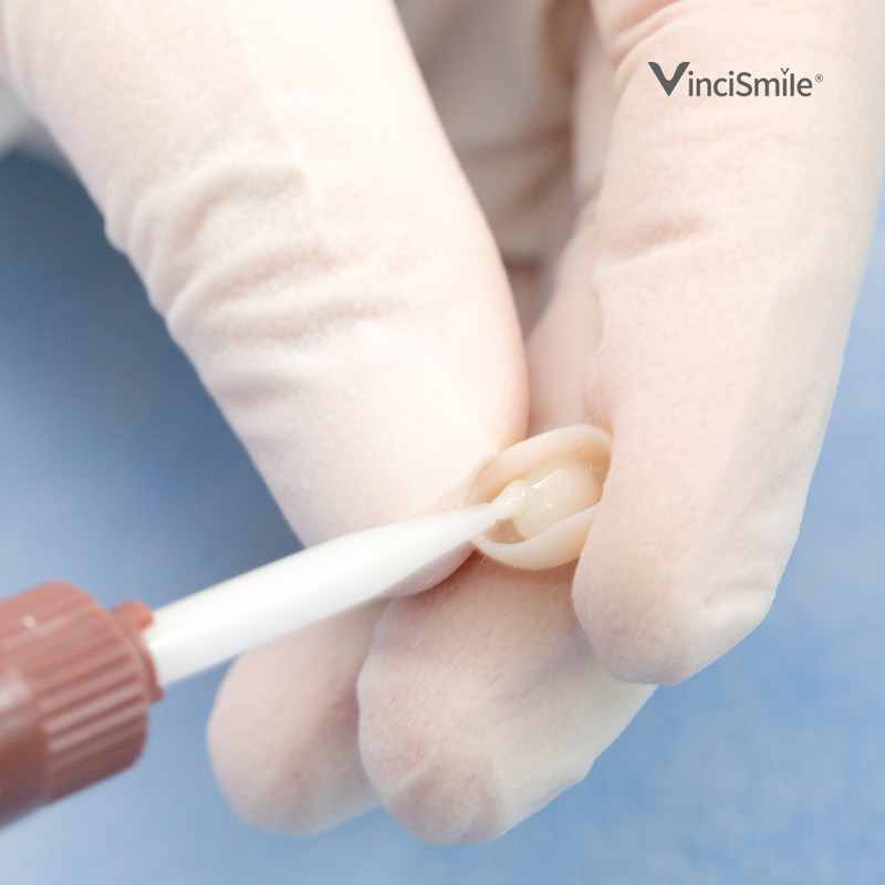 Dental Veneer Cementation Kit:2 Etching Gel/10 Veneer Cement/1 Adhesive/1 Primer