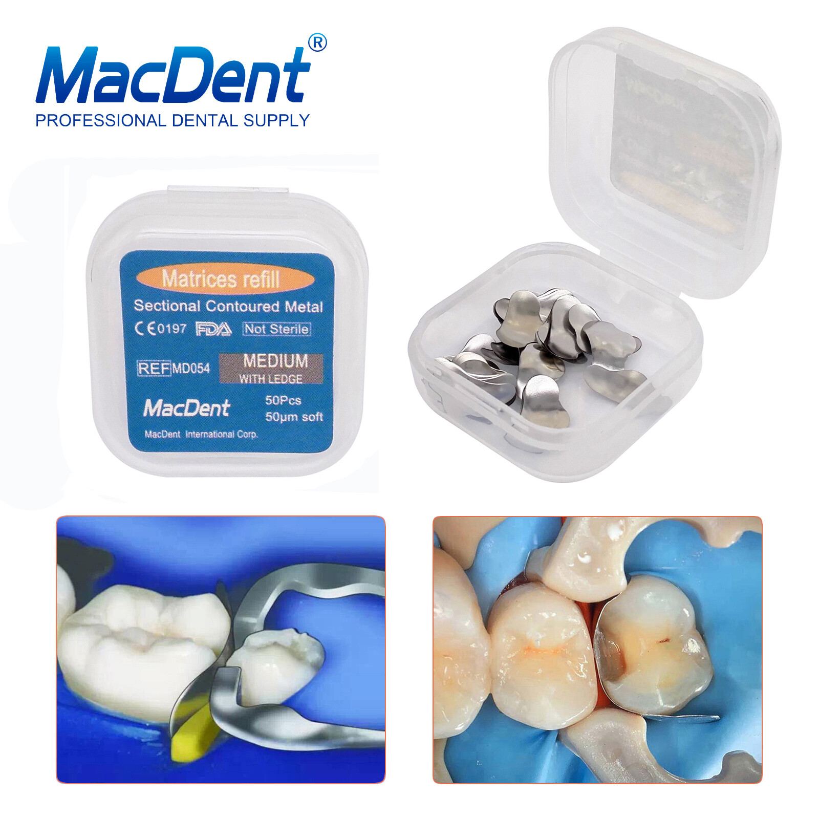 50Pcs/box MacDent Dental Sectional Contoured Matrices Matrix Bands Refill S/M/L