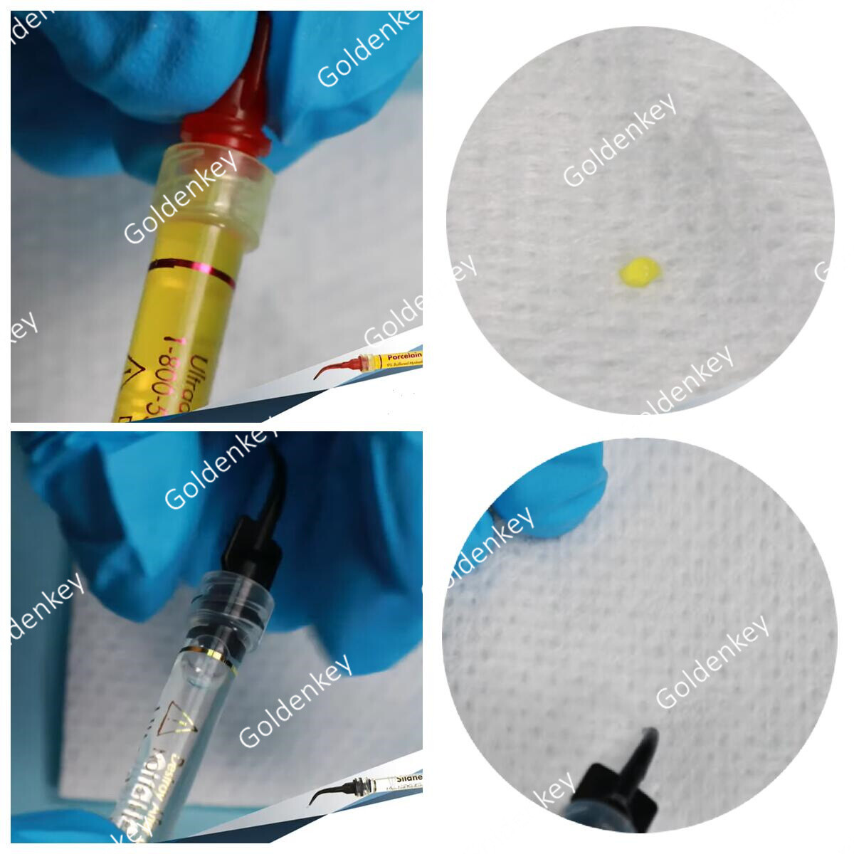 Dental Porcelain Etch Silane Ultradent 9% Hydrofluoric Repari Kit