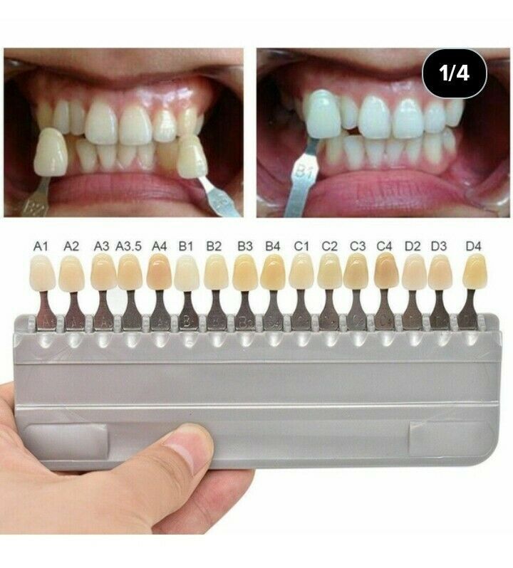 Dental Acrylic Resin Denture False Teeth Upper Lower Full Set A1/A2/A3 Shade USA