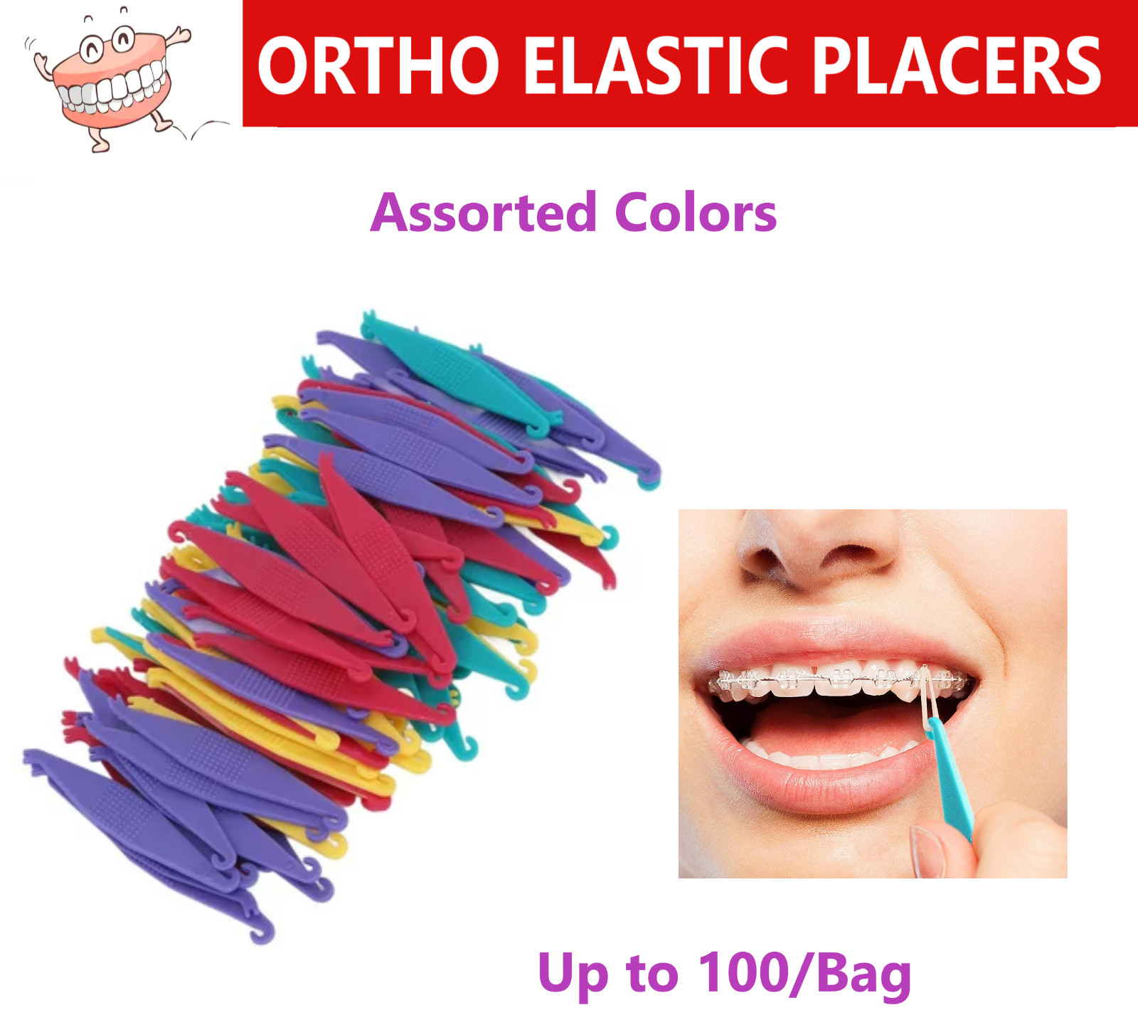 Dental ORTHO ELASTIC PLACERS – Purple, Yellow, Turquoise, Rose, 50/100/Bag