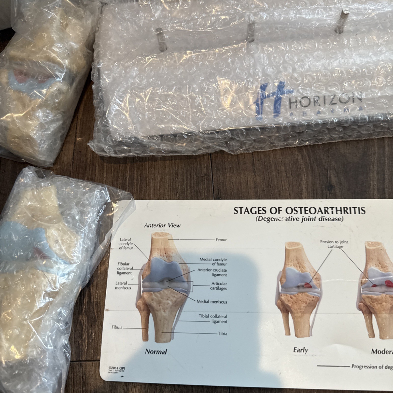 Knee Joint Osteoarthritis GPI Model Set horizon pharma