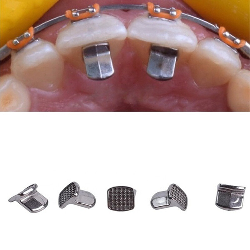 10Pcs Dental Orthodontic MIM Bite Turbos Tongue Tamers Monoblock Bondable Hinge