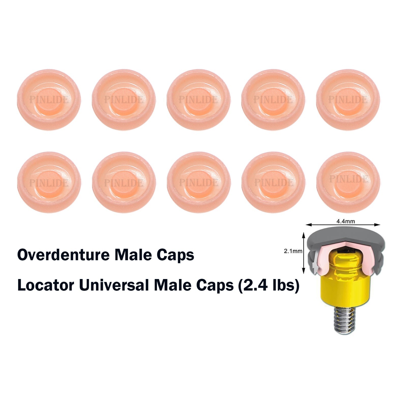US Universal Dental Retention Male Caps 0.8lb 1.2lb 2.4lb Metal Housing