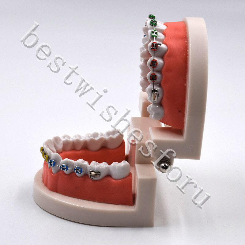 Dental Orthodontic Standard Teeth With Metal Brackets Ligature Ties Hoop Model