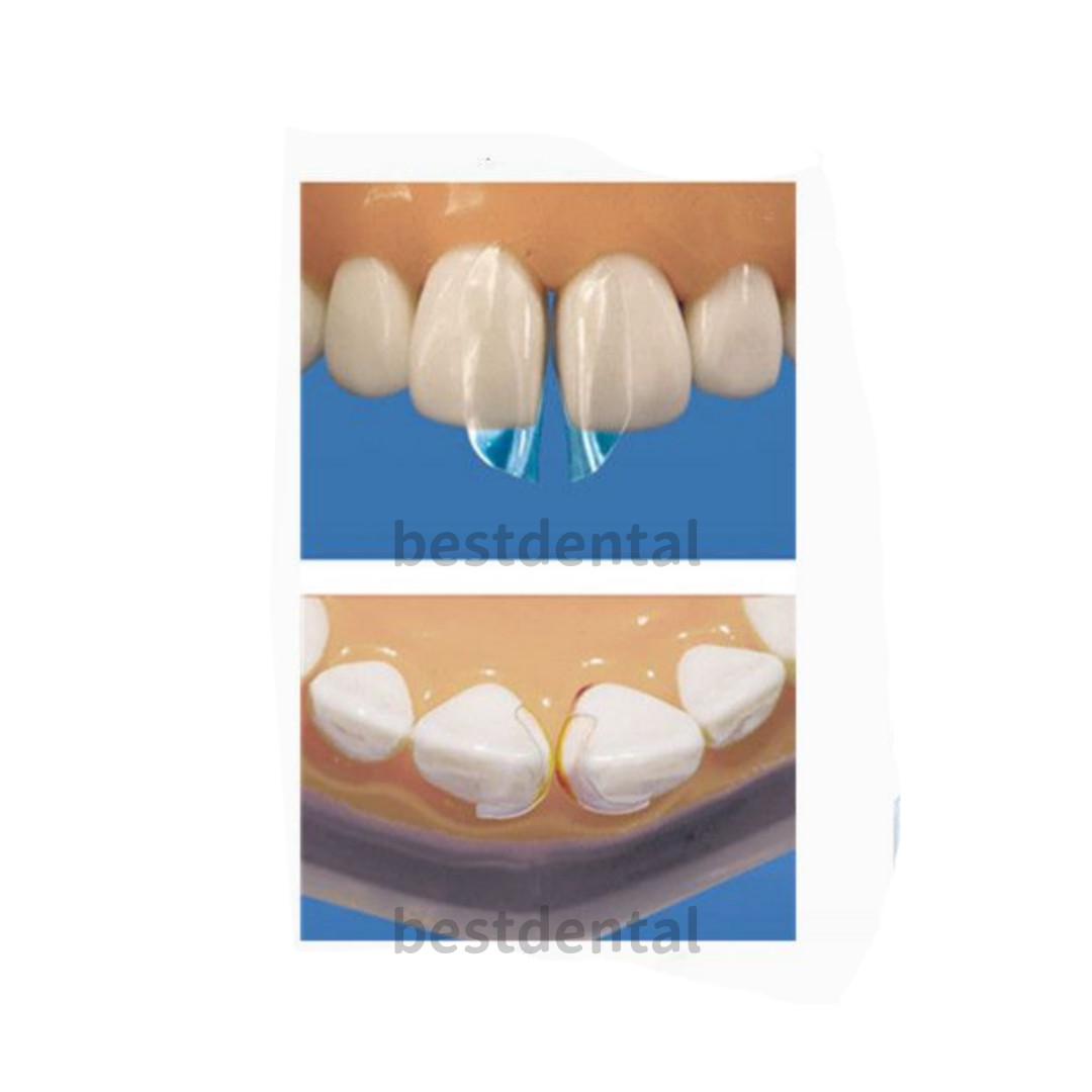 1.901 Mixed Sizes Dental Clear Matrix Anterior Matrices Bow BT Fits Bioclear