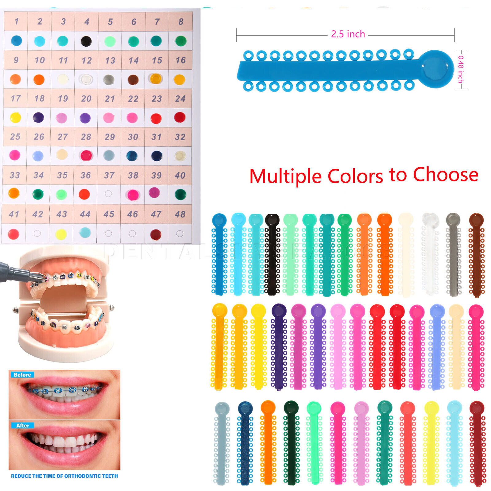 Dental Orthodontic Ligature Ties Elastic Bands for Brackets / Niti Wire Rect