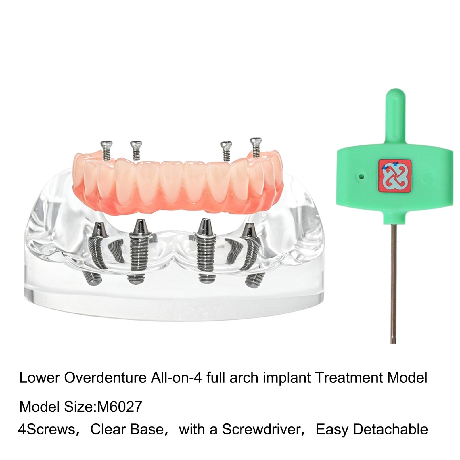 Clear Base Detachable All-on-4 /All-on-6 Overdenture Dental Implant Study Model