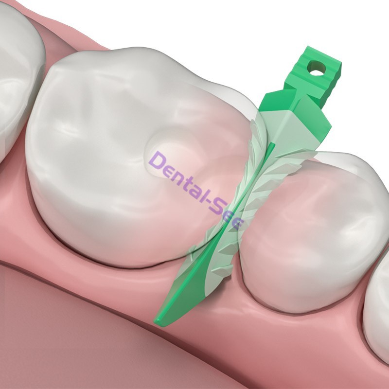 Dental Matrix Bands Ring Sectional Matrice Clamp Wedges Fit Palodent V3 System