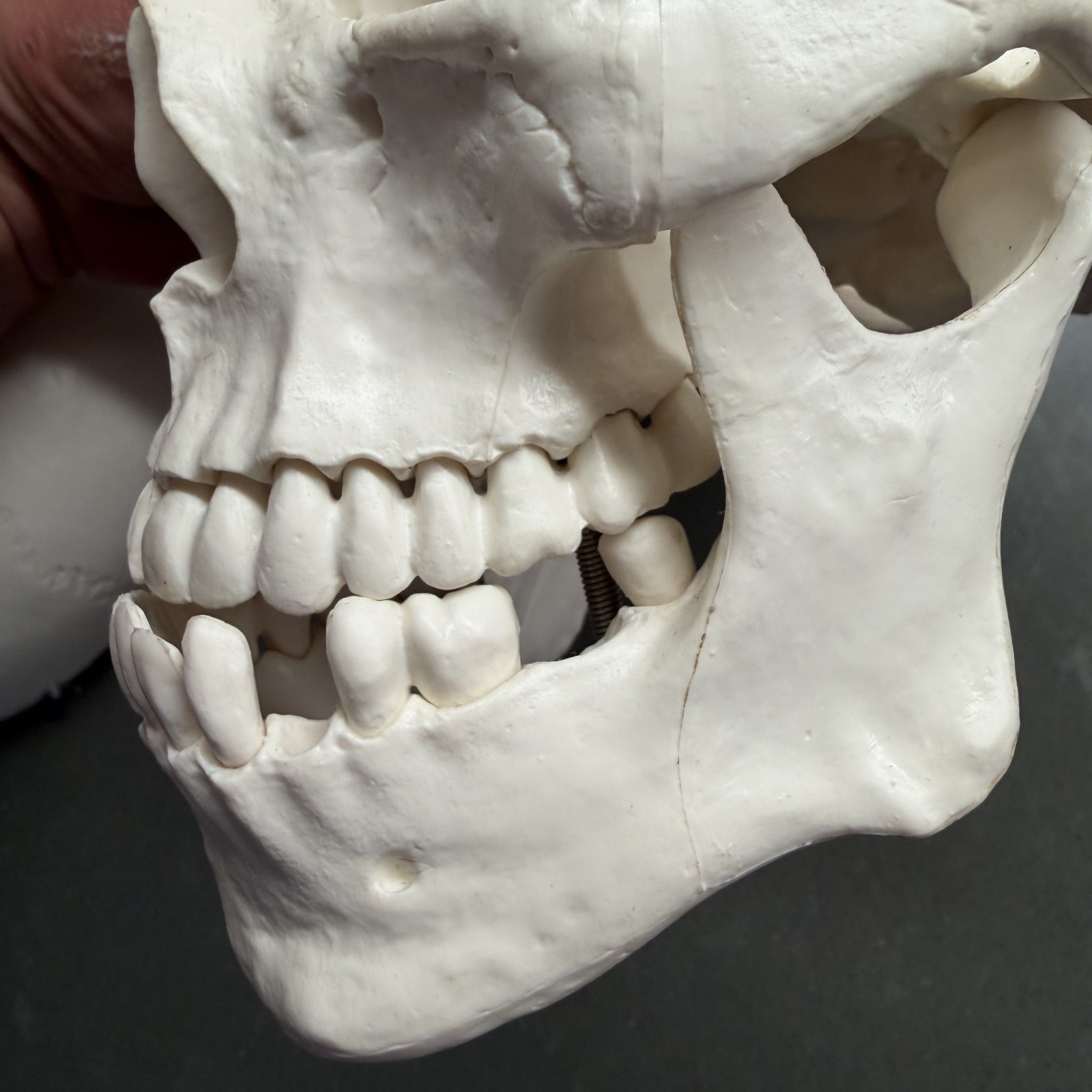 Skull~Medical Dental Anatomical Model~1 To 1~Removable Lower Jaw And Cranium