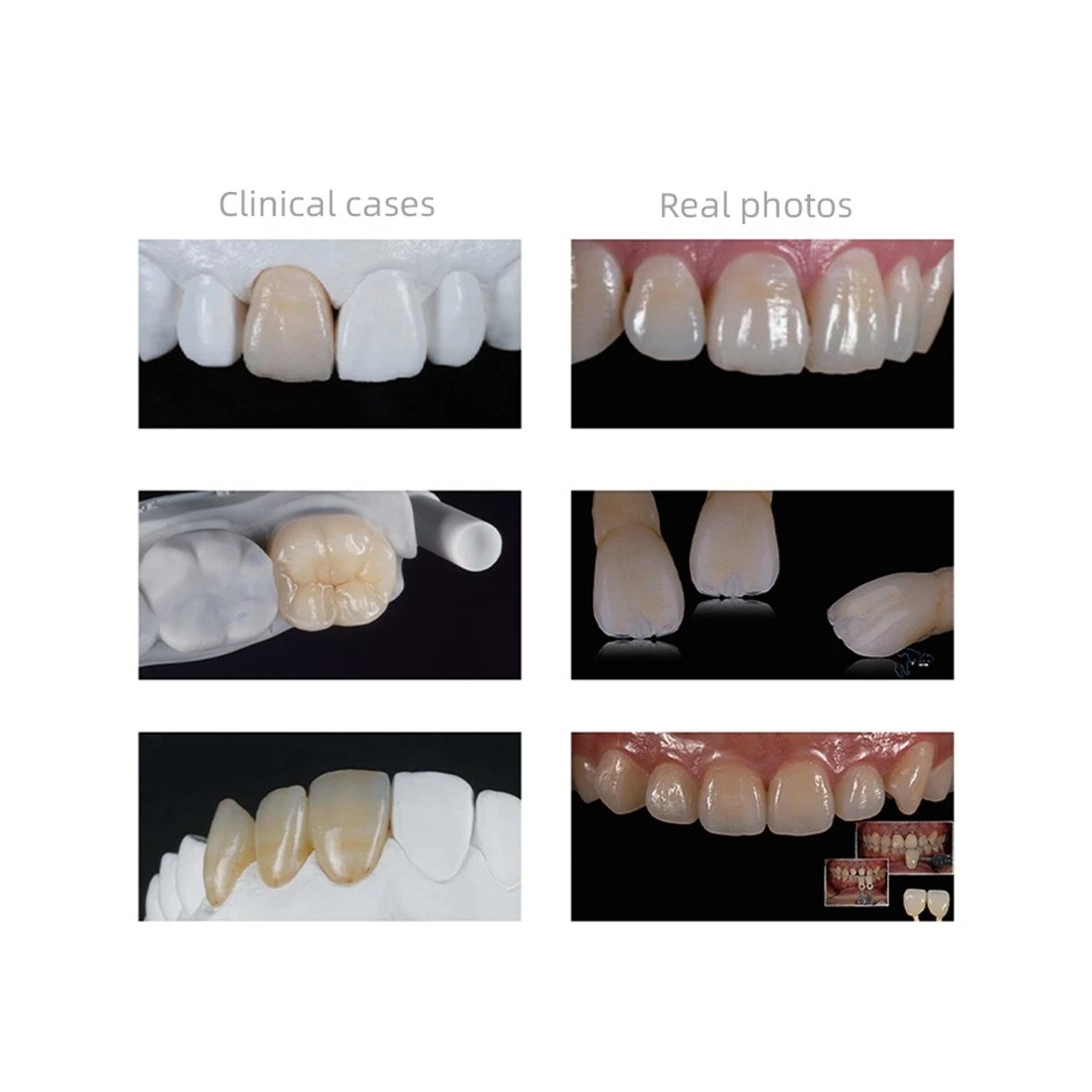 C14 Exam Lithium Disilicate Blocks CAD/CAM Dental Lab CEREC Compatible 5Pcs/Box
