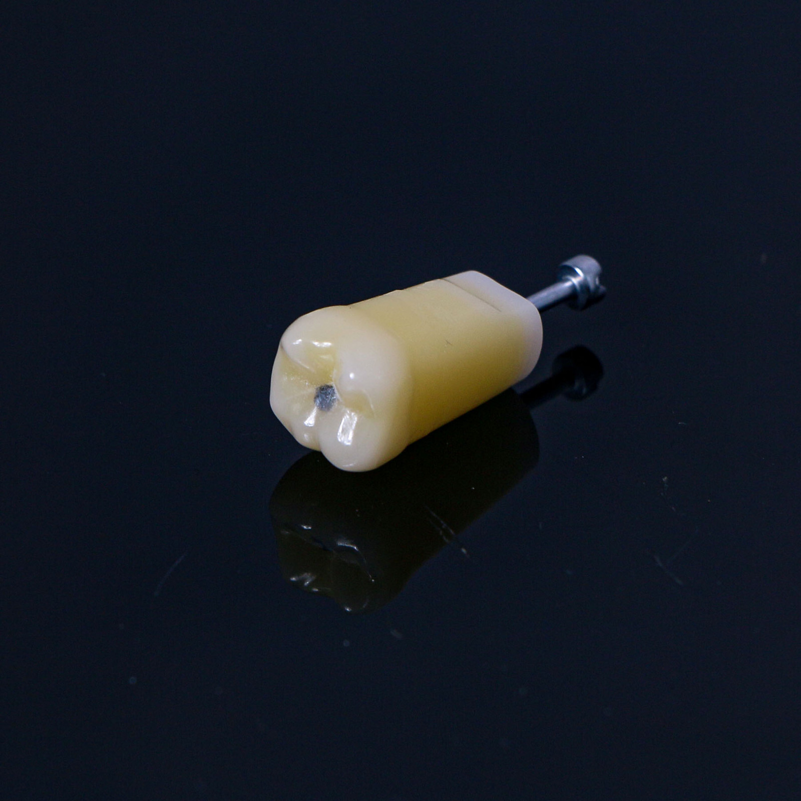 Dental Typodont Teeth Model with Caries Spots 28 Pieces Fits Kilgore Nissin 200