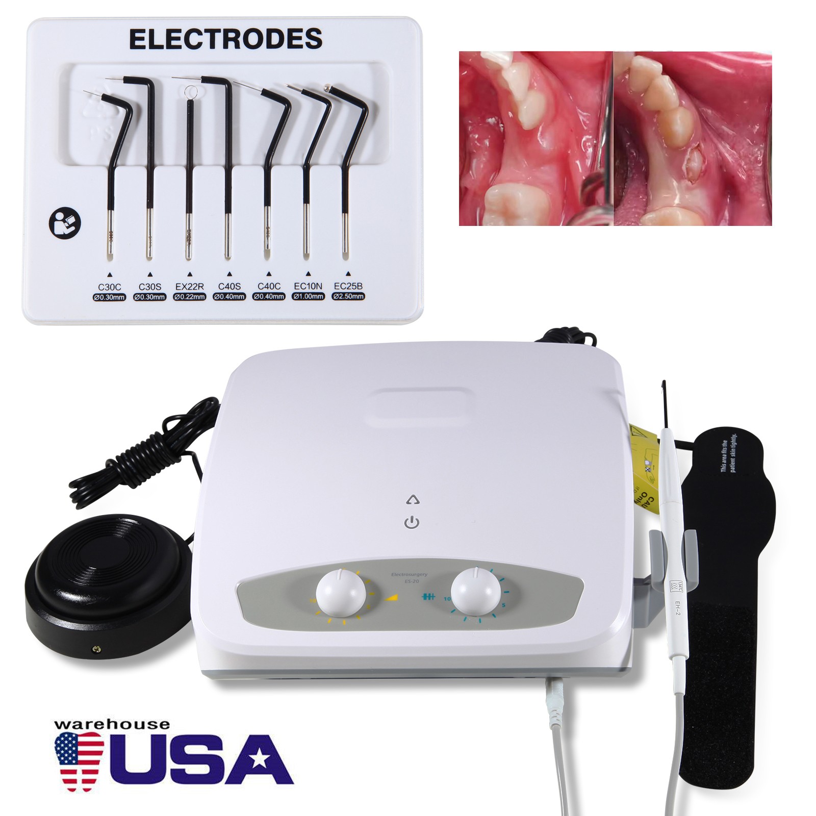 Dental Occlusal Mirror Fog Free LED Intra Oral Photo System 3*Mirrors Anti-Fog
