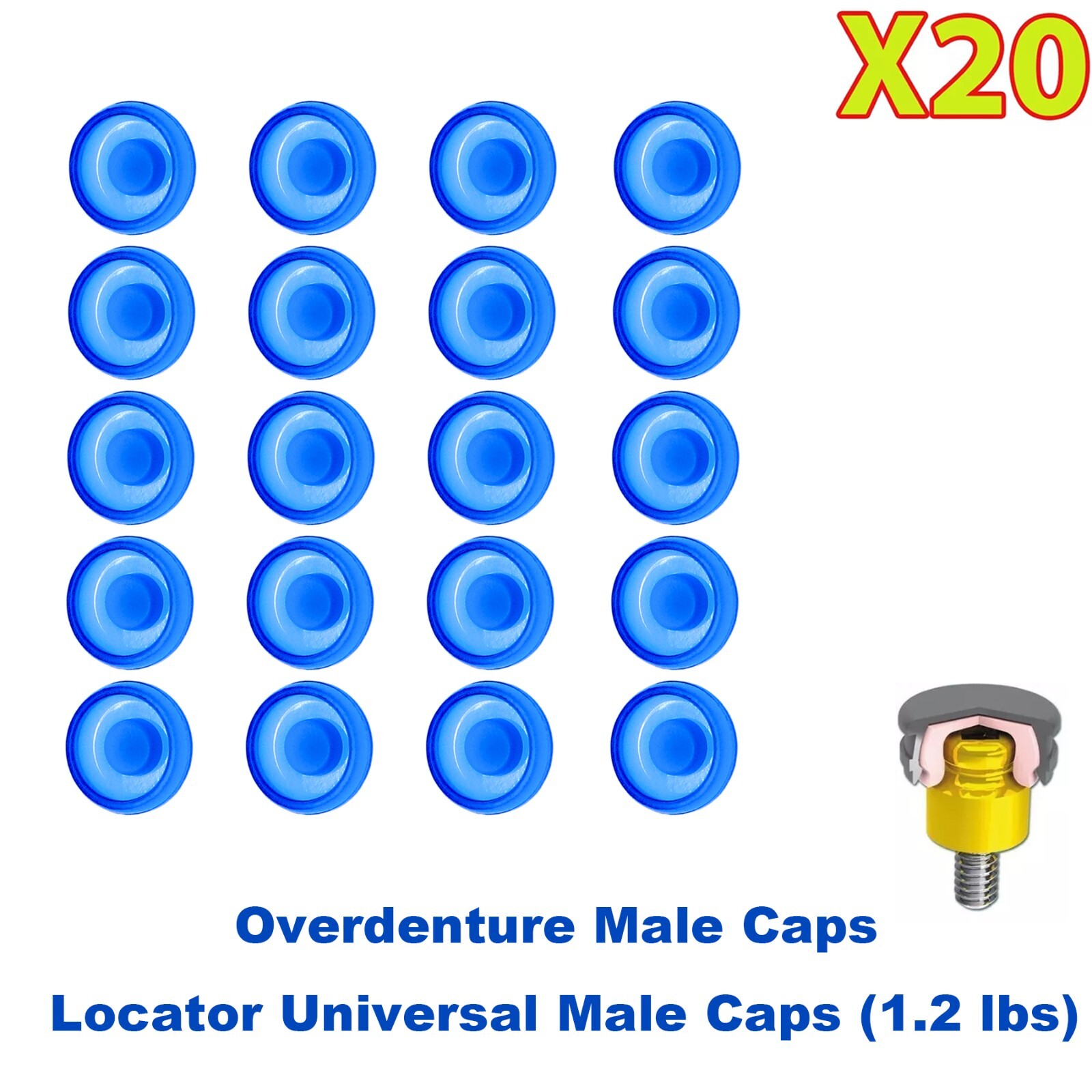 US 20Pcs Dental Overdenture Mini Retentive Caps 1.2/2.4lbs for Implants Locator