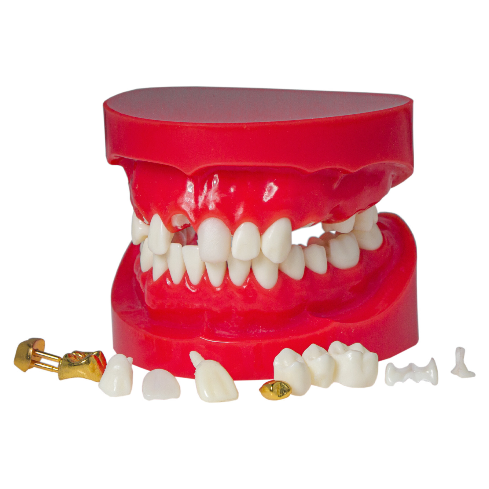 Implant Typodont Teeth Restoration Model Overdenture Practice Demo Series Dental