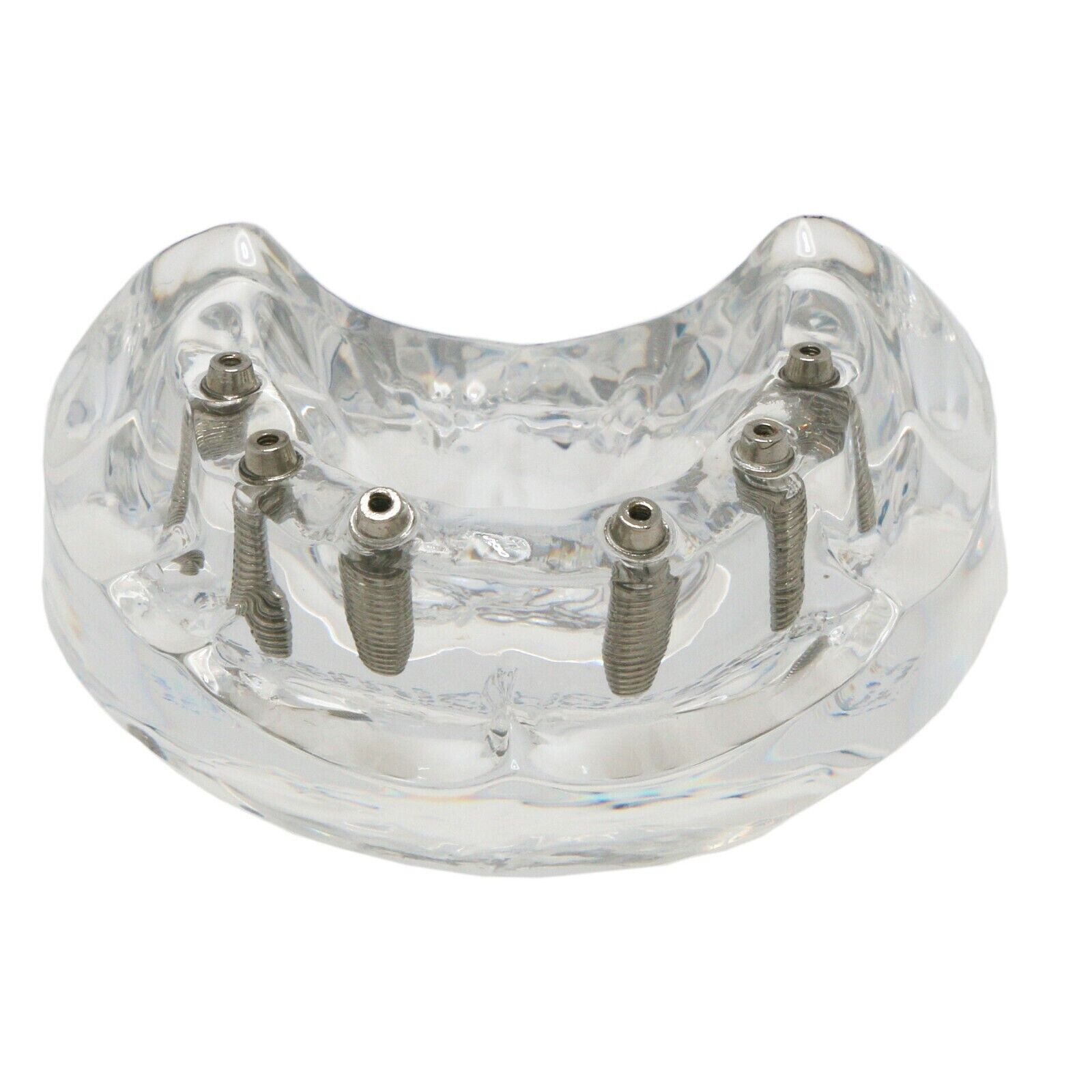 US Dental Implant Restoration Model Upper Jaw 6 Screws Post Core Bridge M6001-2