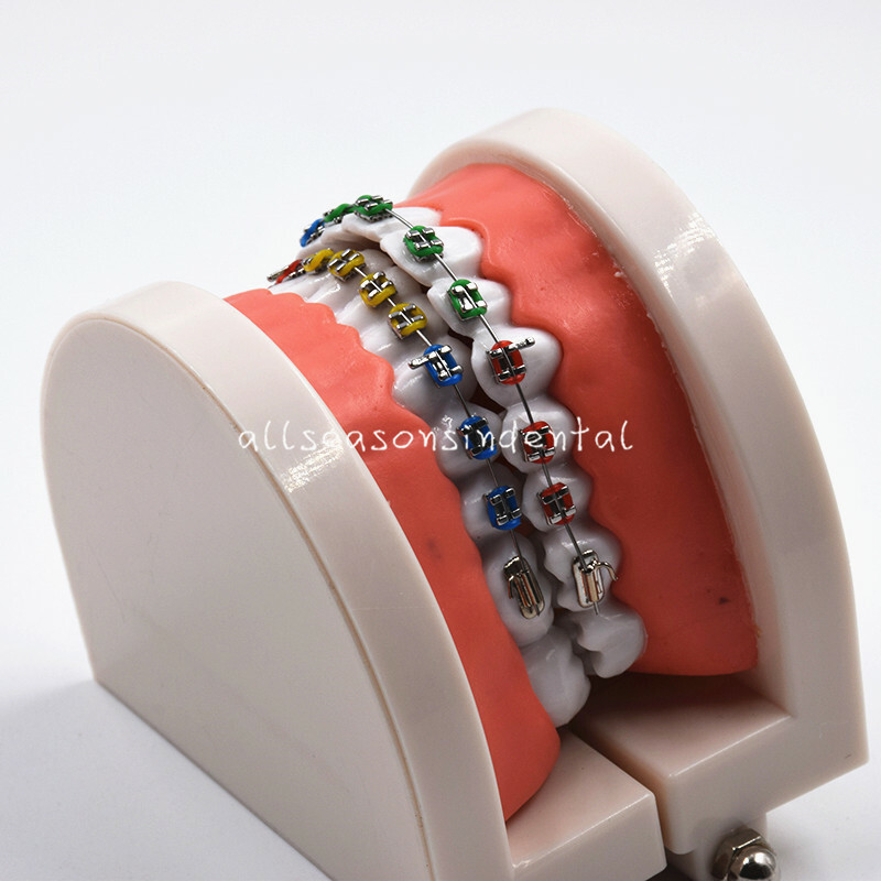 Dental Orthodontic Adult Standard Teeth Hoop Model Metal Brackets Ligature Tie