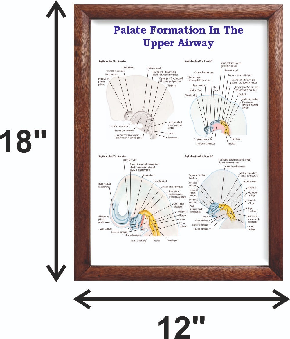 Palate Formation In The Upper Airway Chart 12×18 inches