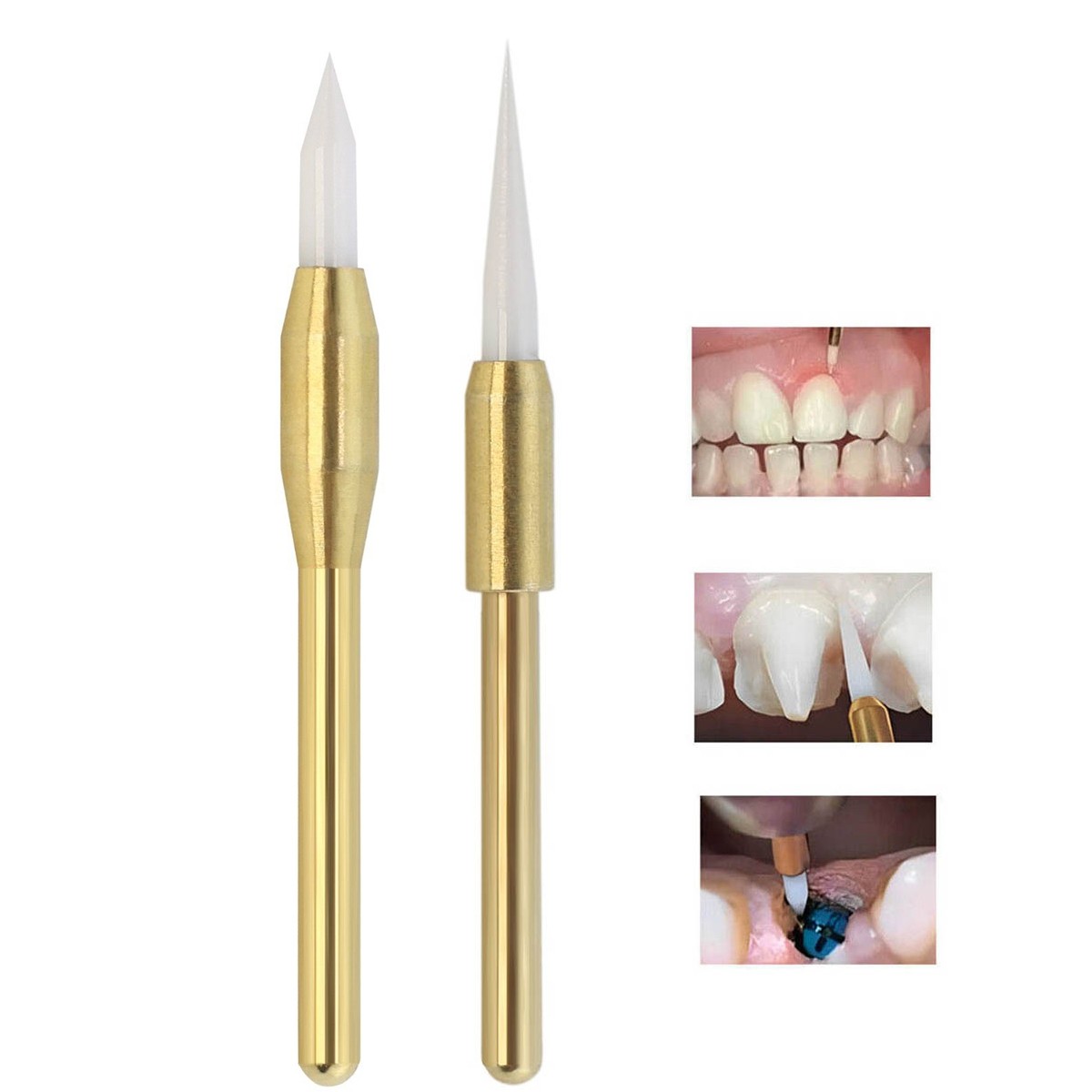 Dental Surgical Soft Tissue Trimmer Ceramic Bur 21/23mm Gingival Gingivectomy