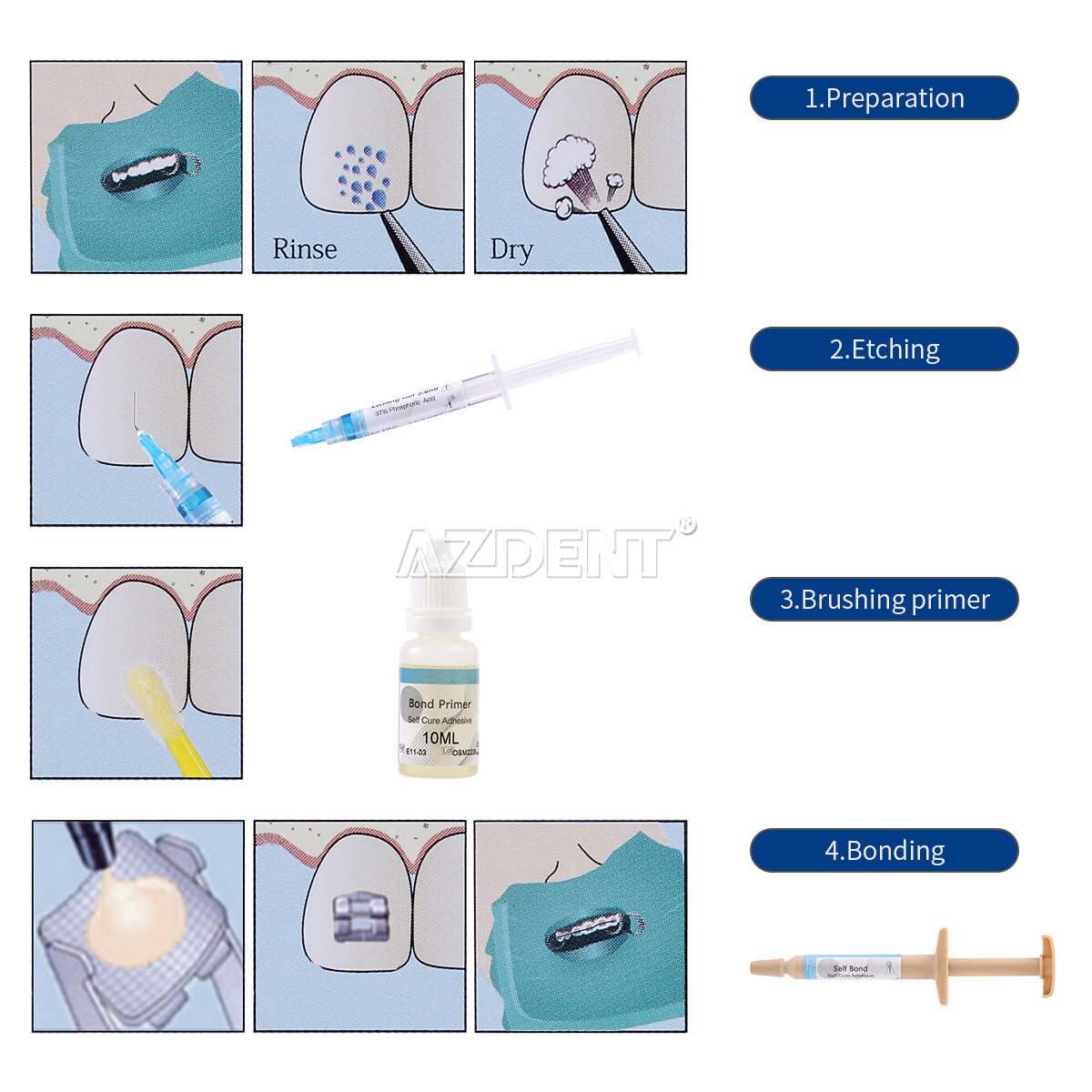 Dental Orthodontic Light Cure Brackets Bonding Adhesive Bonding Etch Gel System