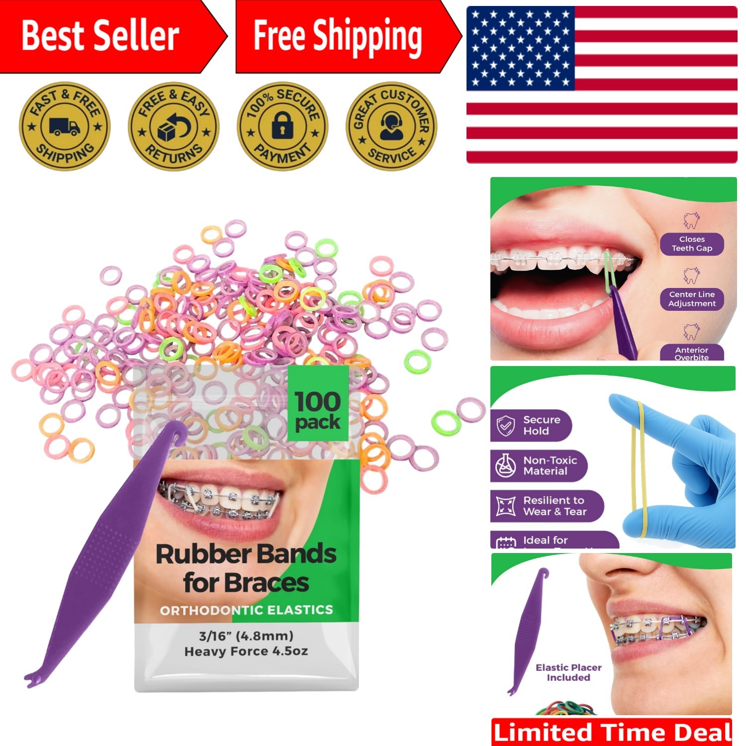 Versatile 100-Pack Neon Orthodontic Rubber Bands with Free Elastic Placer