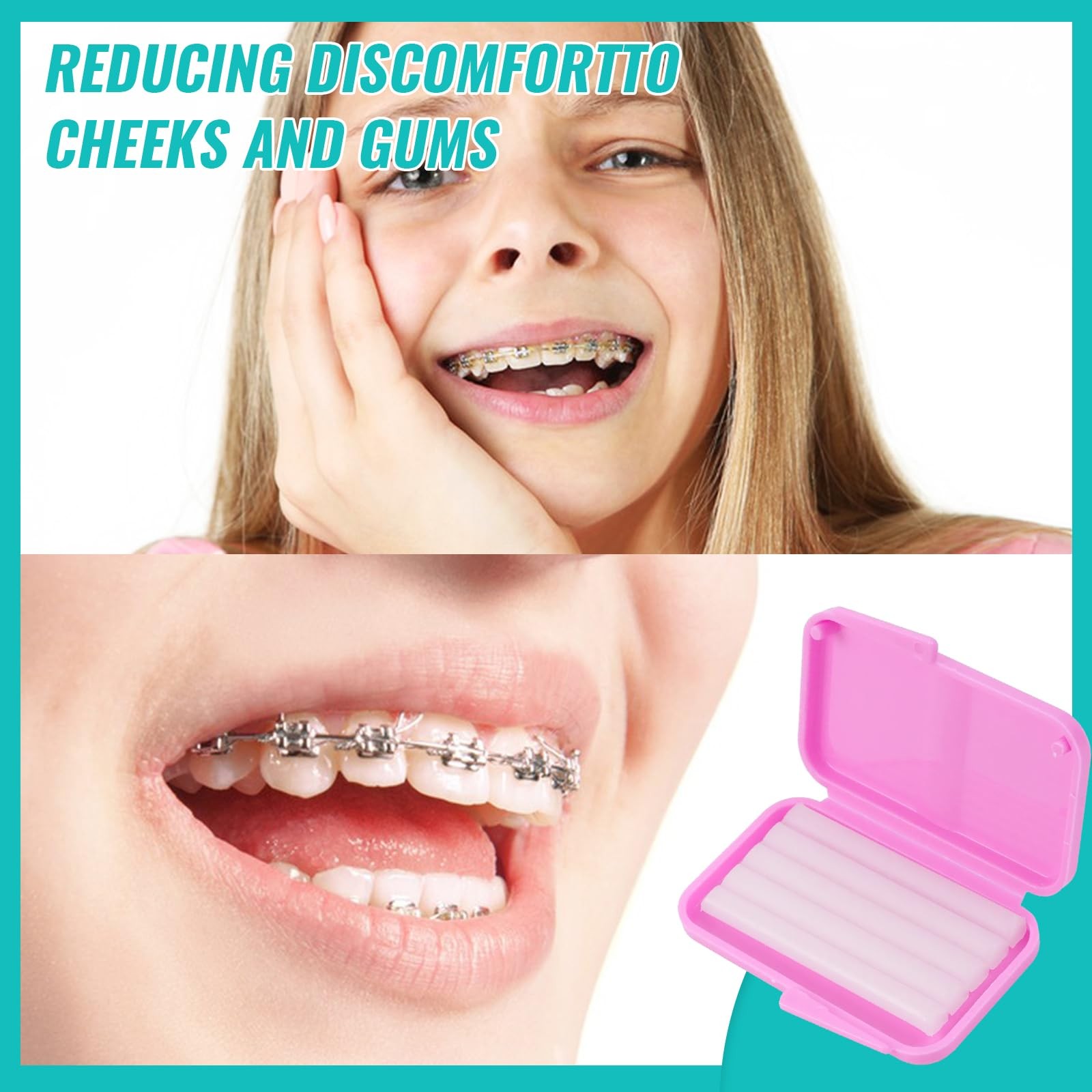 10 Pack Dental Braces Wax for Teeth & Aligners, 50 Unscented &…