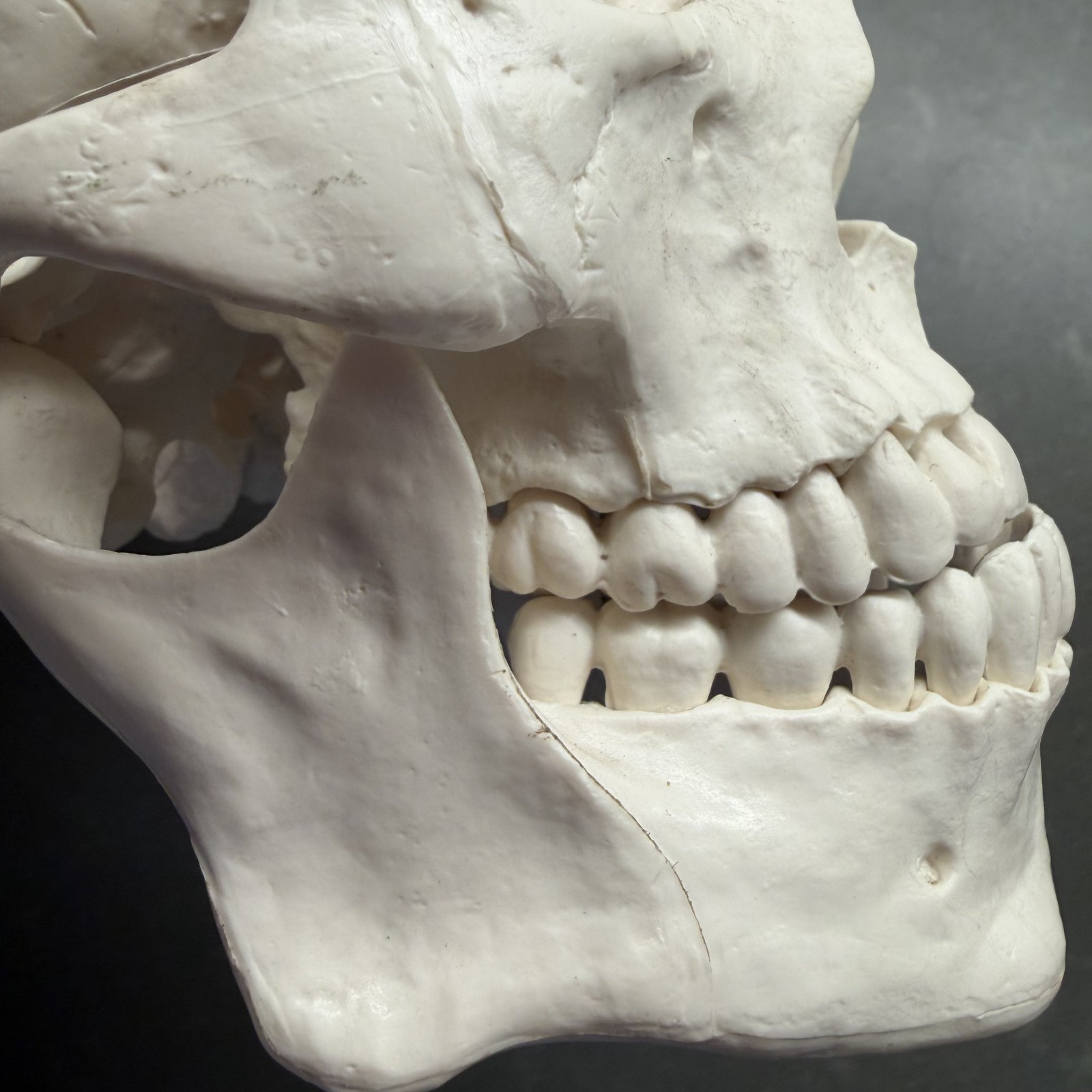 Skull~Medical Dental Anatomical Model~1 To 1~Removable Lower Jaw And Cranium