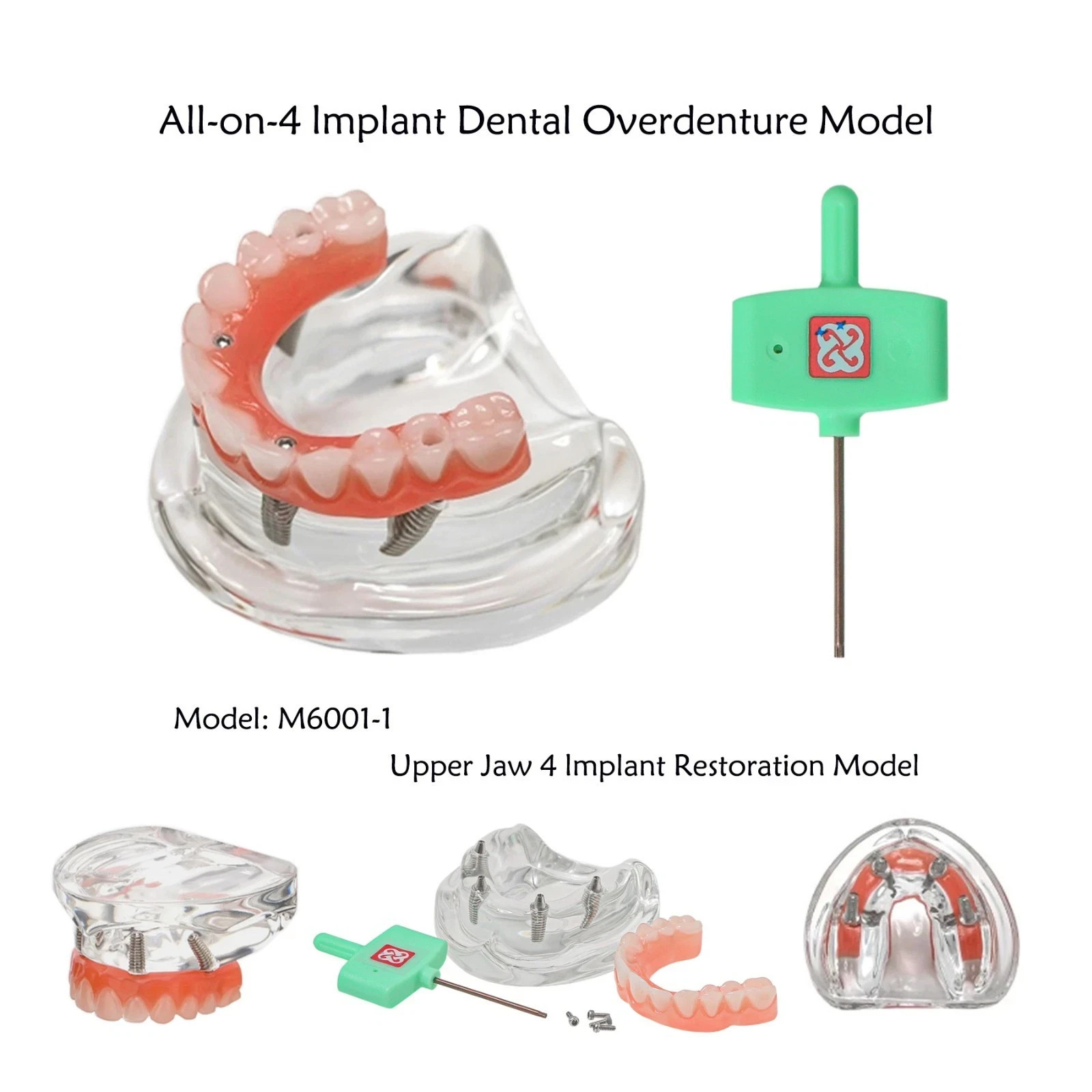 US Dental Overdenture All-on-4/6 Upper/Lower Jaw Teeth Model with 4/6 Screws
