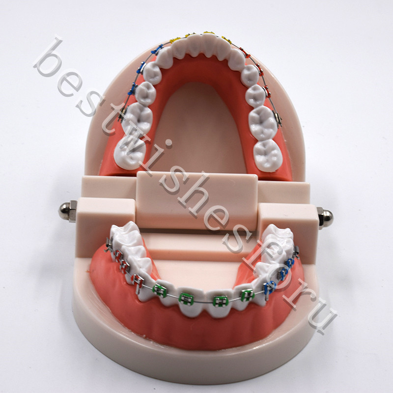 Dental Orthodontic Standard Teeth With Metal Brackets Ligature Ties Hoop Model
