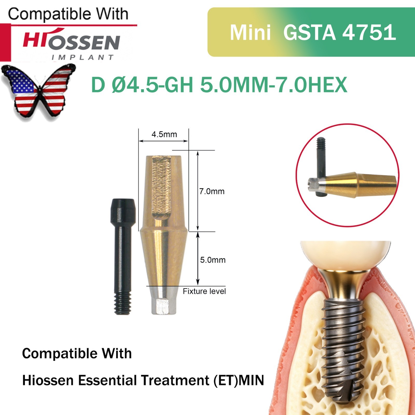 Straight Abutment Fit Osstem Hiossen ET Mini Regular Hex Implant Cement Retained