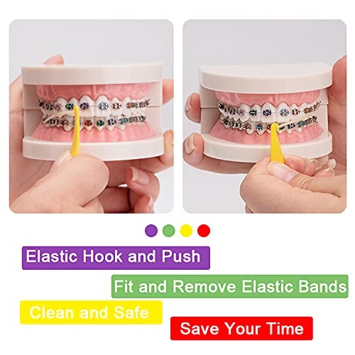 20 Pack Braces Rubber Band Tool Dental 20 Count (Pack of 1), multi-colored