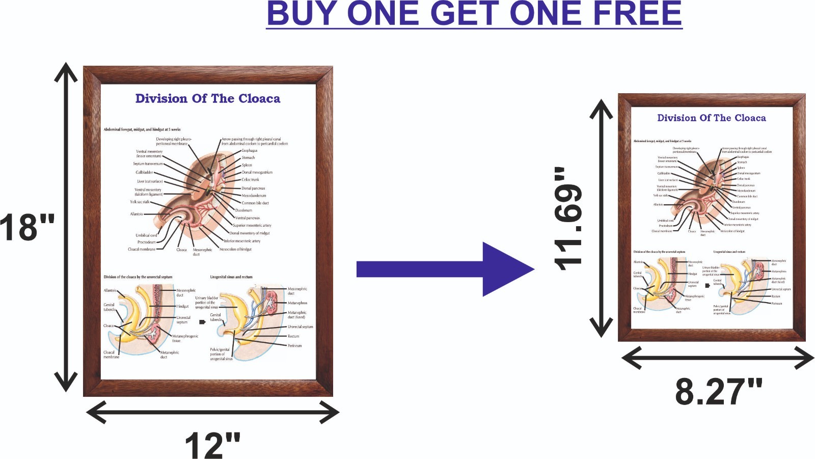 Division Of The Cloaca Chart 12×18 inches