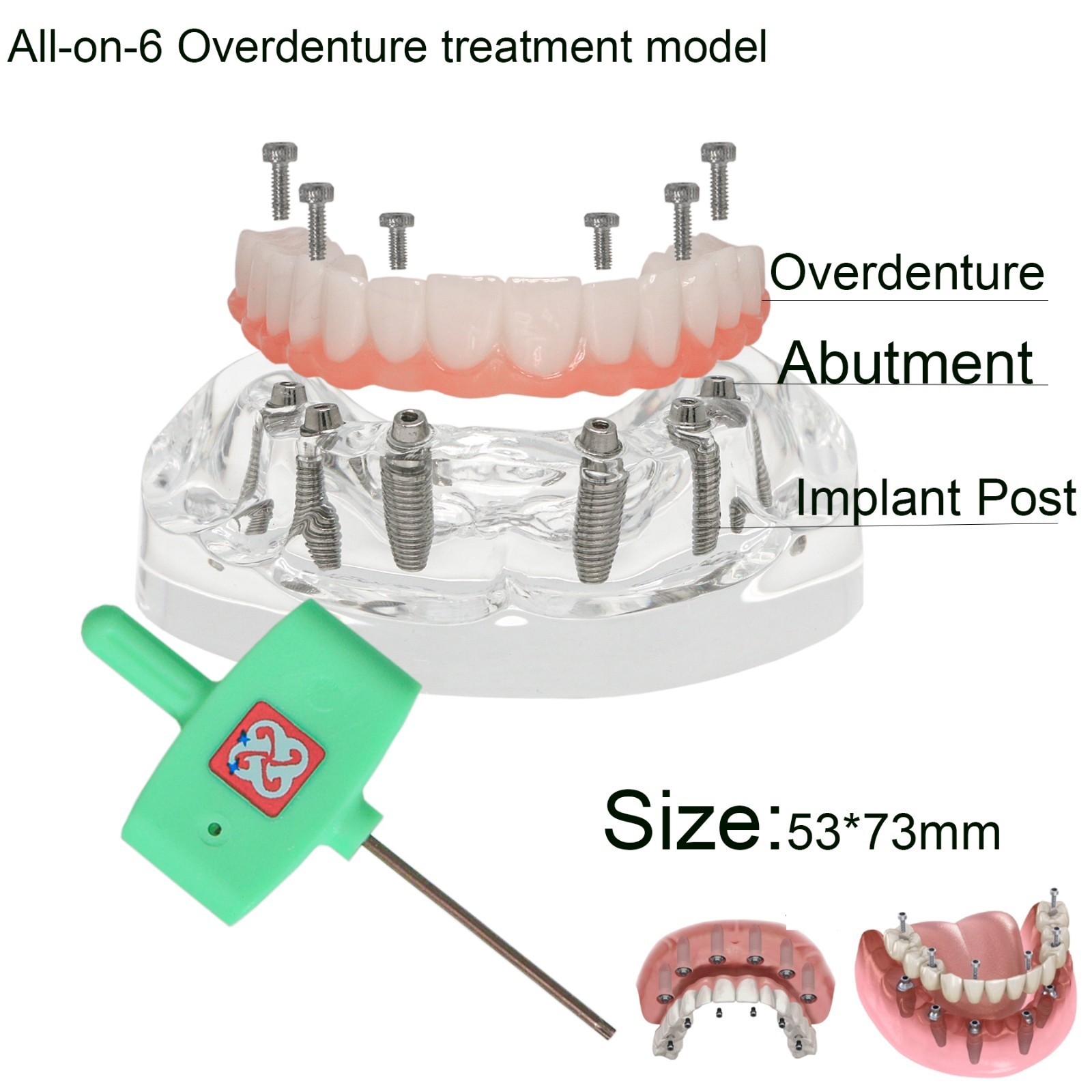 Clear Base Detachable All-on-4 /All-on-6 Overdenture Dental Implant Study Model