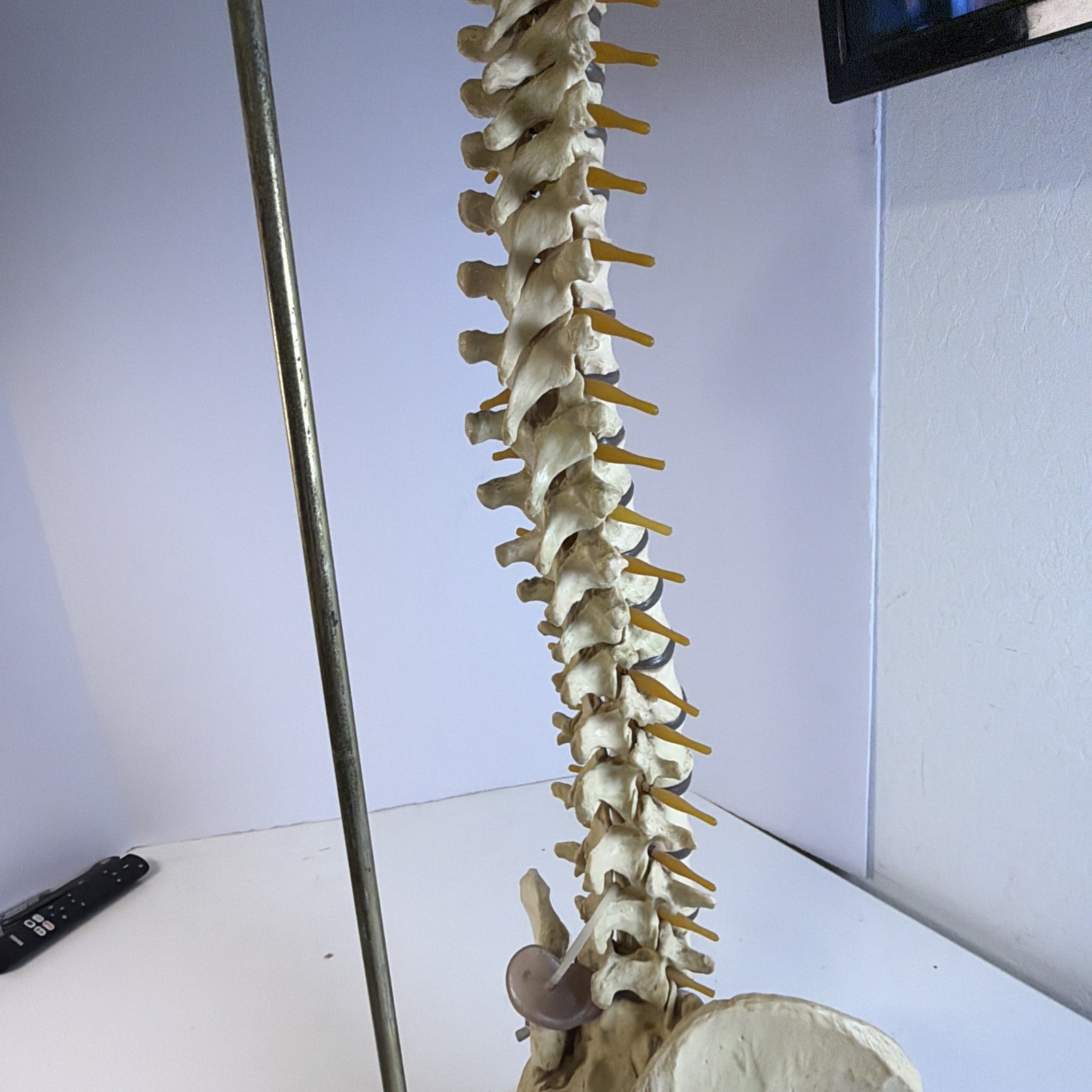 Vintage ORTHOFLEX Human Pelvis Vertebrae Skull Base Spinal Nerve Cord Spine