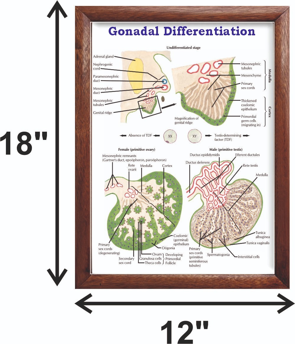 Gonadal Differentiation Chart 12×18 inches