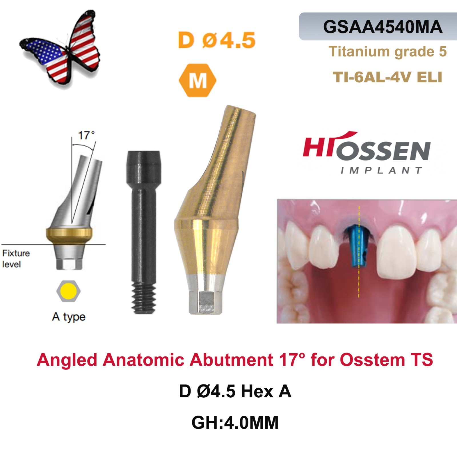 US 17° Dental Angled Anatomic Abutment Hiossen/Osstem TS Mini/Regular Platform