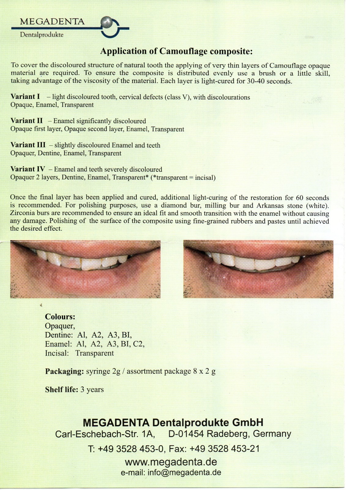 Dental Camouflage Flow Nano composite for direct laminate veneers Germany