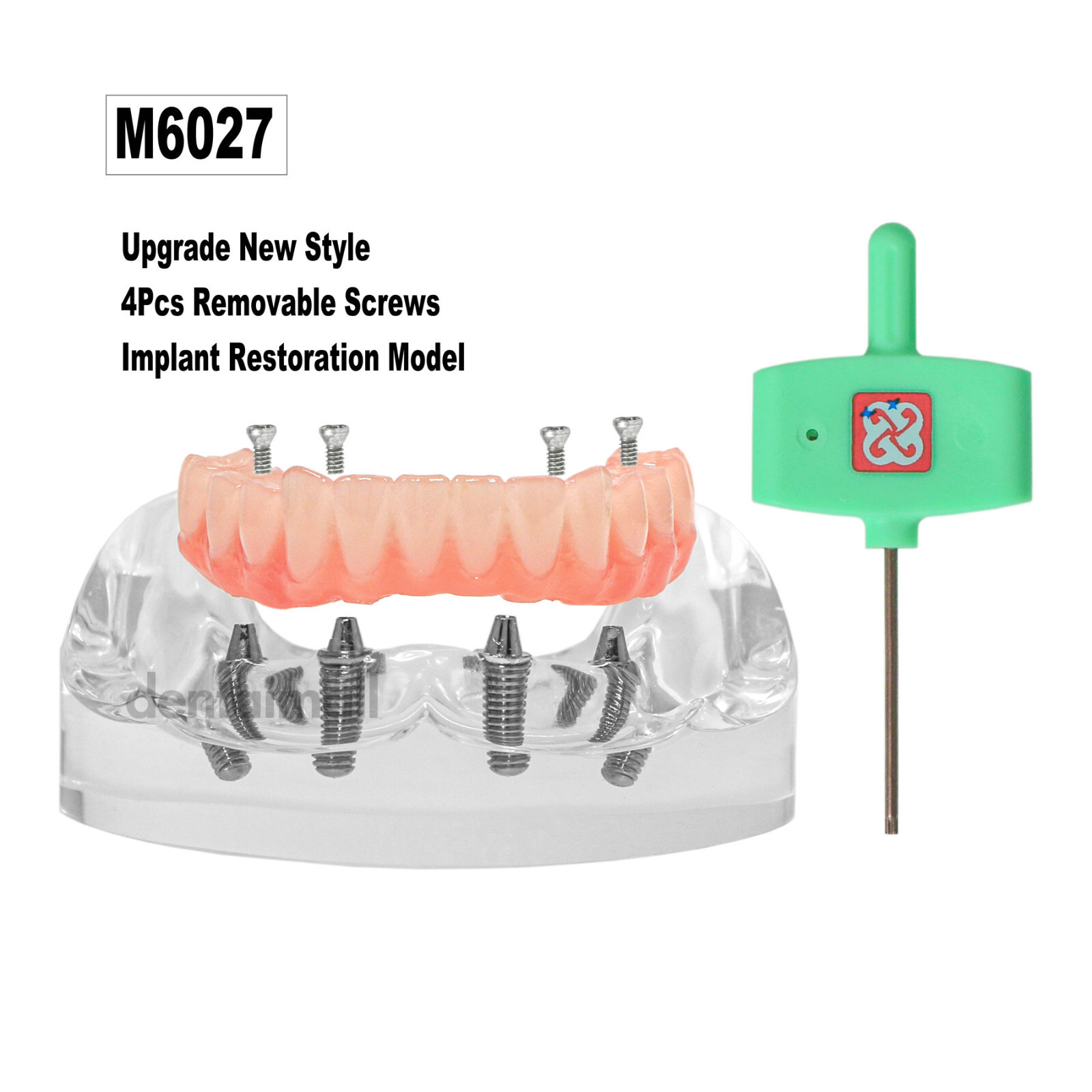 Dental 4 Implants Upper&Lower Demo Implant Teeth Model Restoration Overdenture