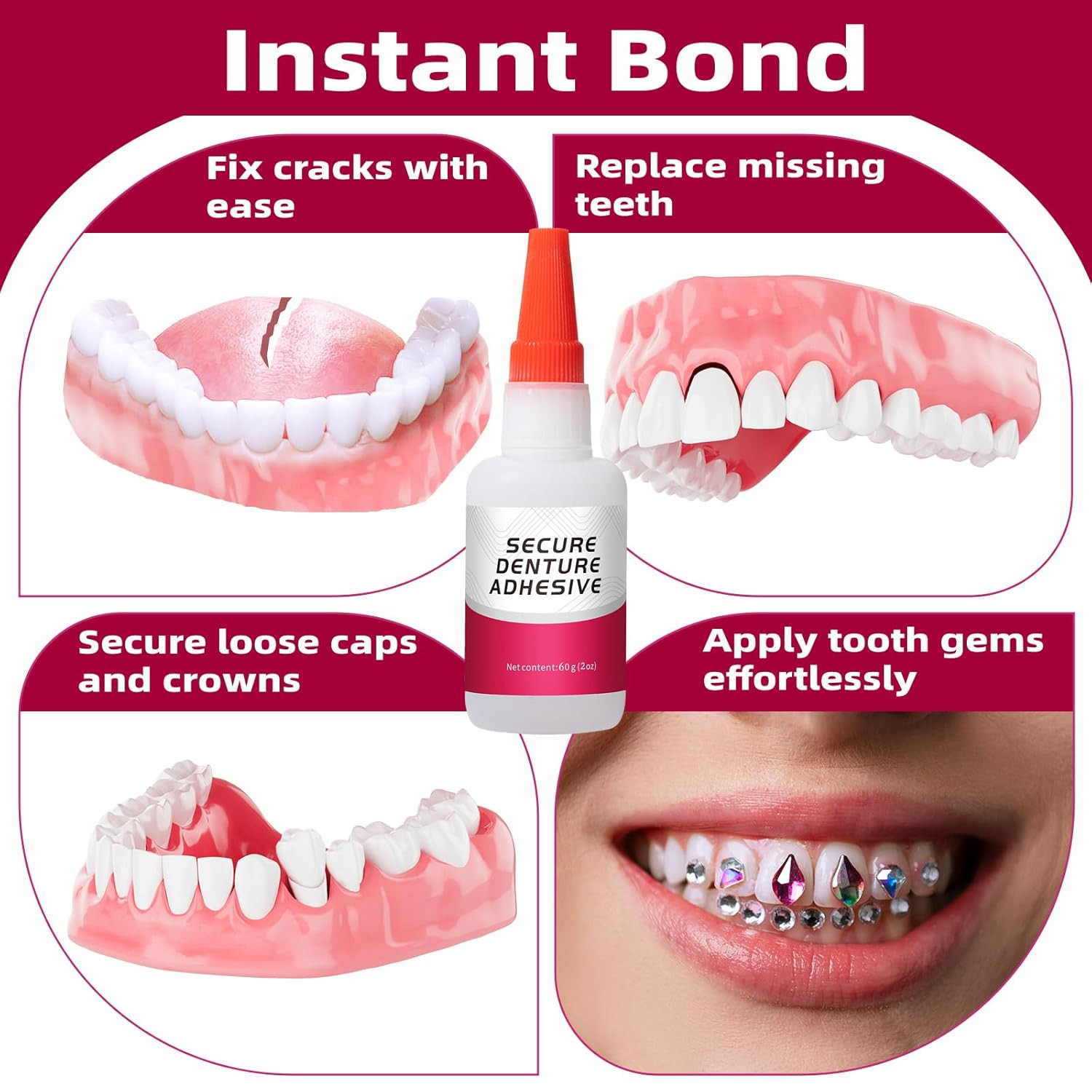 Dental Lab Instant Bonding Dental Glue (1Oz), Repair Cracks & Secure Loose Teeth
