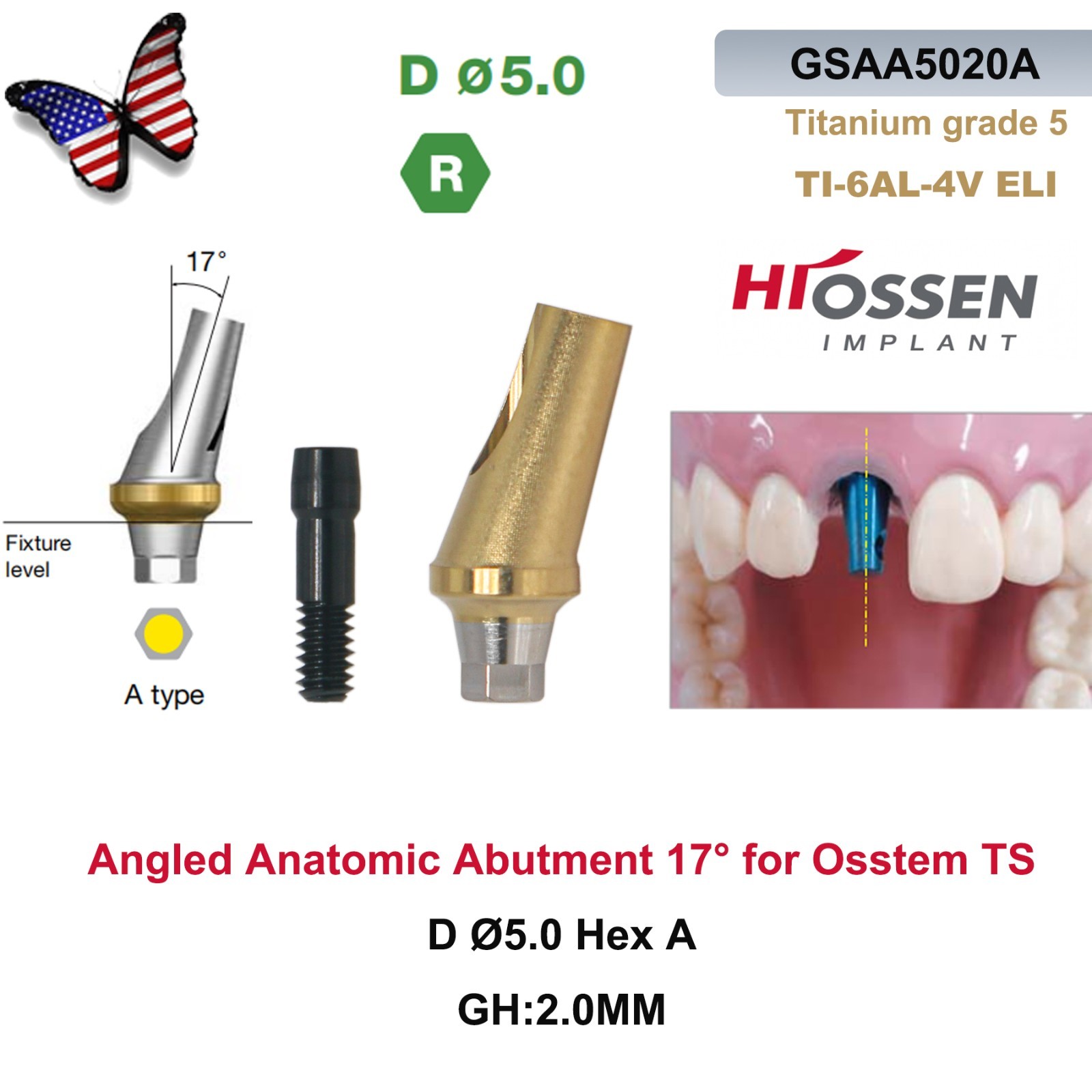 US 17° Dental Angled Anatomic Abutment Hiossen/Osstem TS Mini/Regular Platform