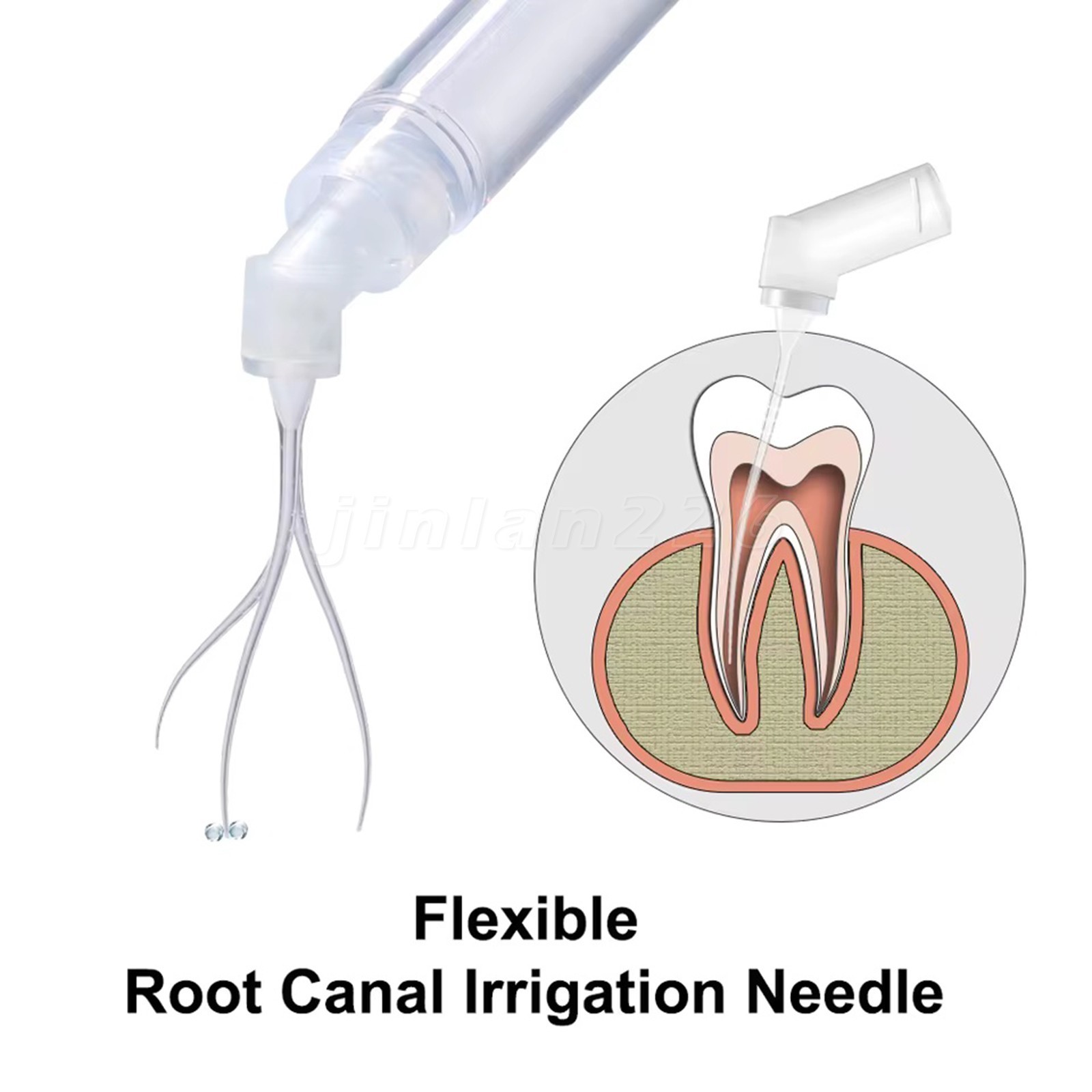 20-400Pcs Dental Endo Root Canal Tip Irrigator Irrigation Needle Tips Flushing